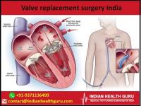 valve replacement surgery india image 1